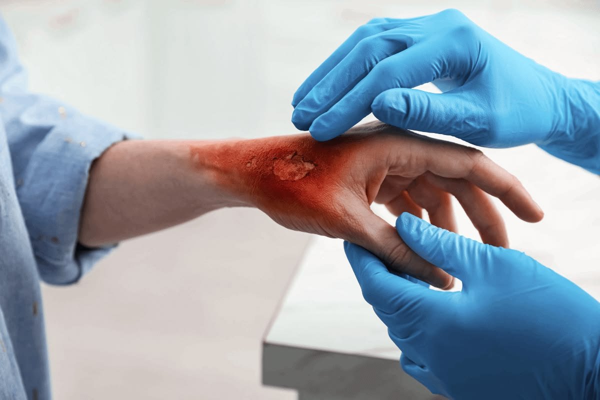 Surgical Wound Healing